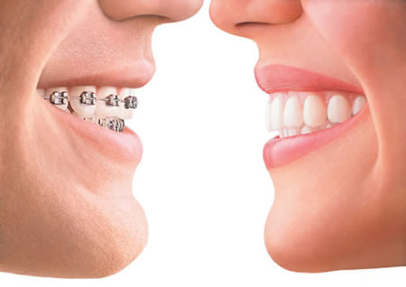 orthodontist springfield va