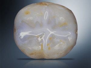 sealants