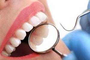 gingivitis